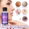 Achill Remover Serum 10ML